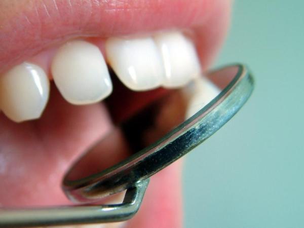 Come nascondere i denti separati