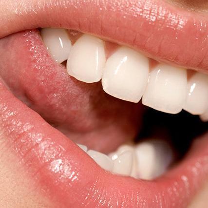 Cosa significa sognare che ti cadono i denti