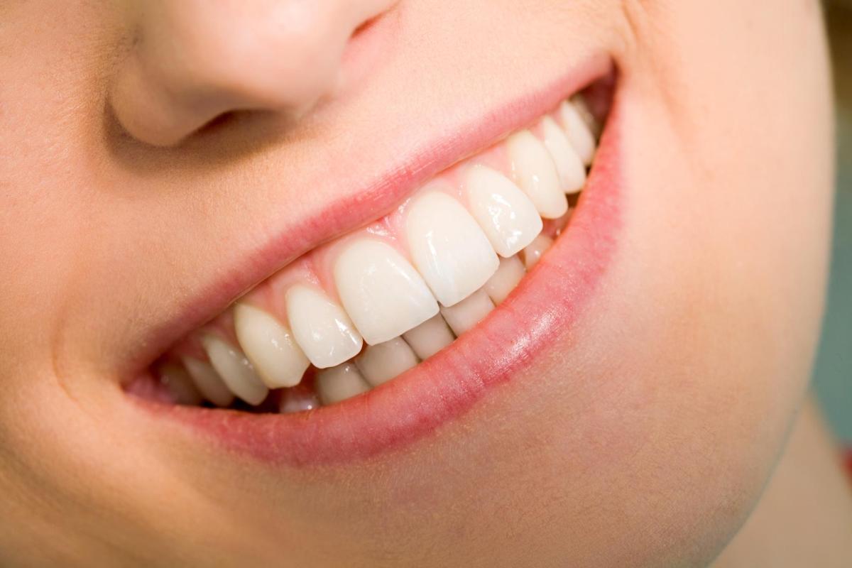 Come dissimulare i denti troppo grandi