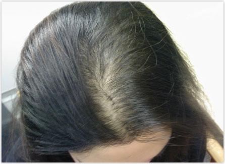 Come infoltire i capelli radi - Prevenire è meglio che curare