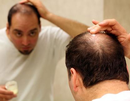 Come utilizzare Minoxidil