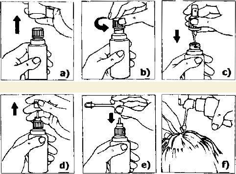 Come utilizzare Minoxidil - Passo 3