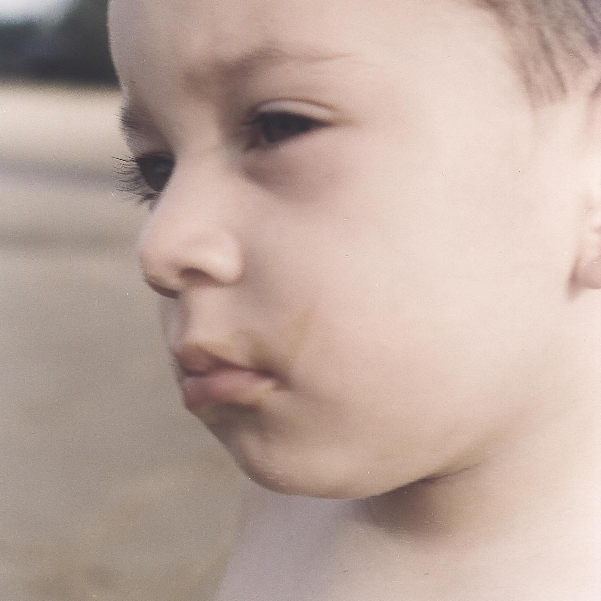 Come curare la pelle molto secca nei bambini