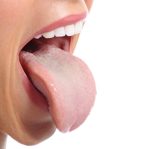 Come curare l'infiammazione delle papille gustative