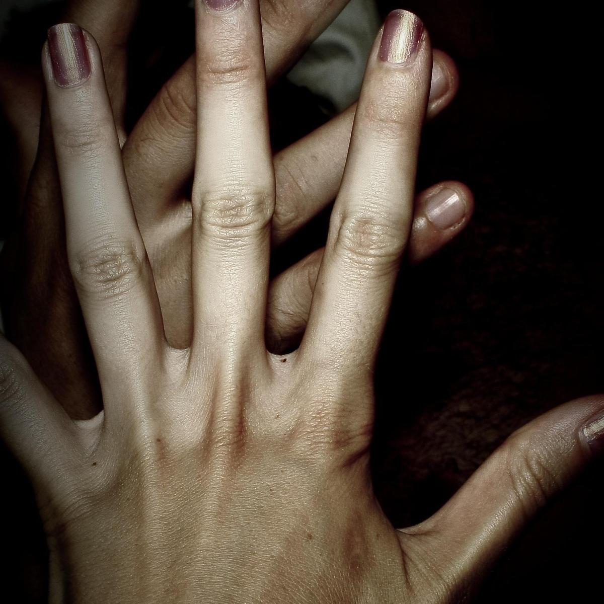 Come togliere i noduli artritici dalla mano