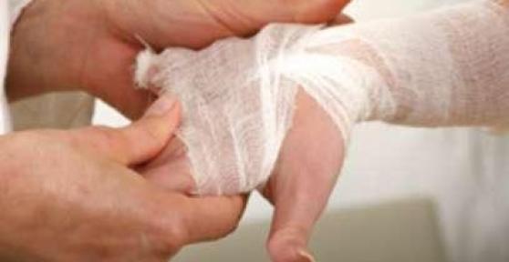 Come curare un'ustione da moto